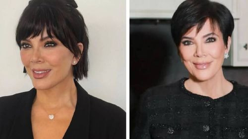Kris Jenner muestra su rostro tras un lifting de 100 mil dólares y genera debate en redes sociales